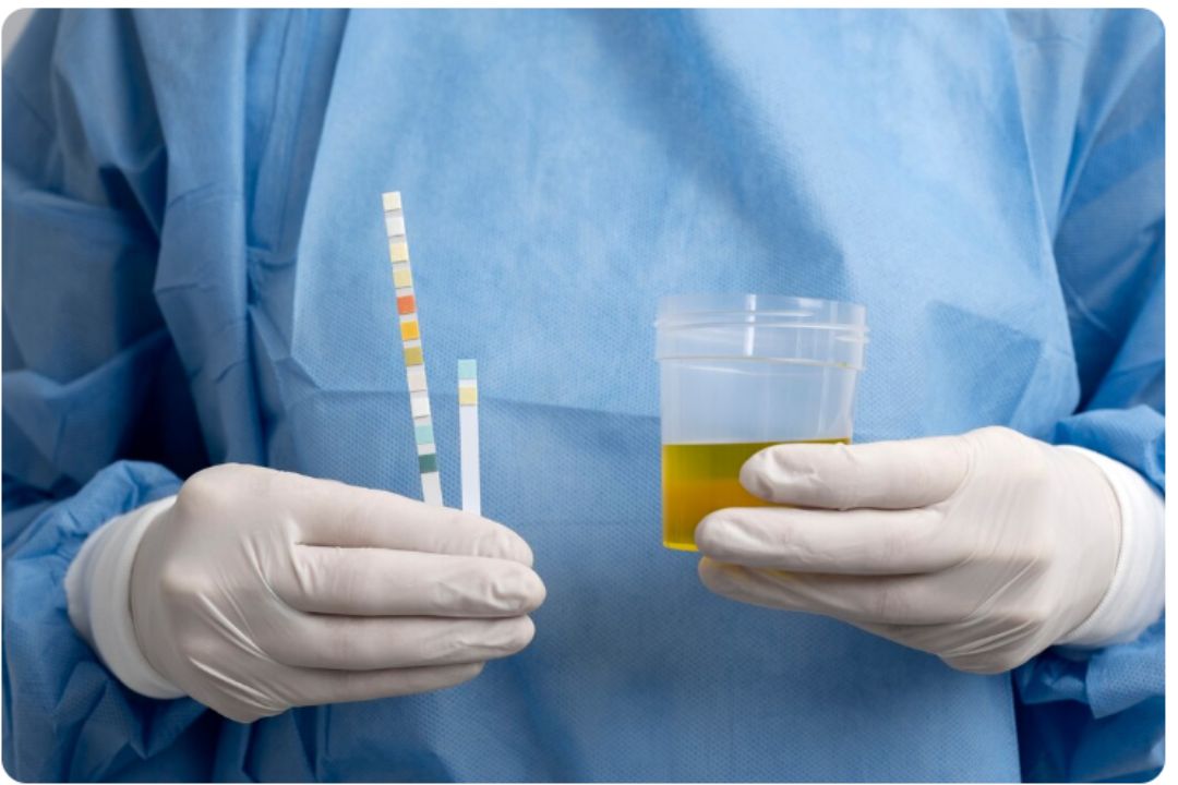 urine sodium test  